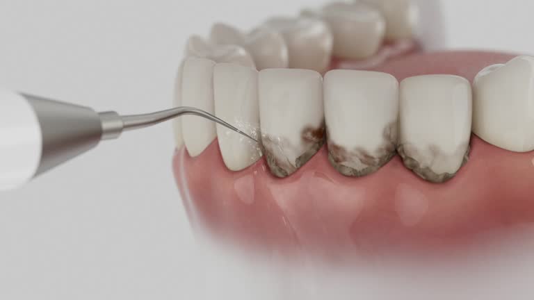 Reliable Dental Implants contractor in Gillette, NJ by Smile Center Dentistry